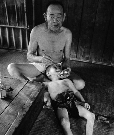 Một bệnh nhân bị dị tật bẩm sinh do mẹ nhiễm độc khi đang mang thai, được ông ngoại cho ăn.